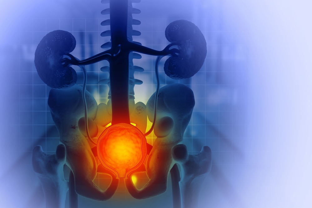 BPH Treatment in Van Nuys, CA