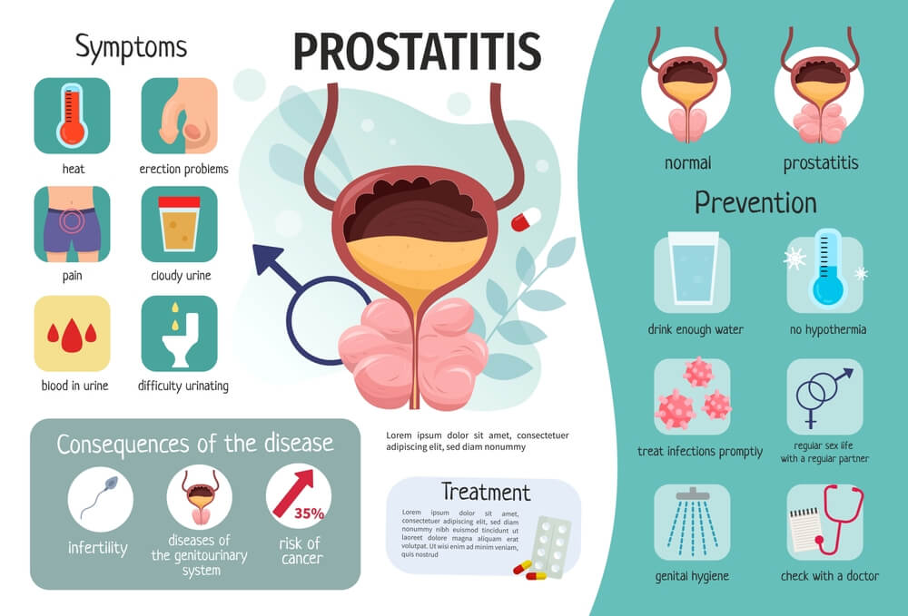Prostate Artery Embolization in Van Nuys, CA