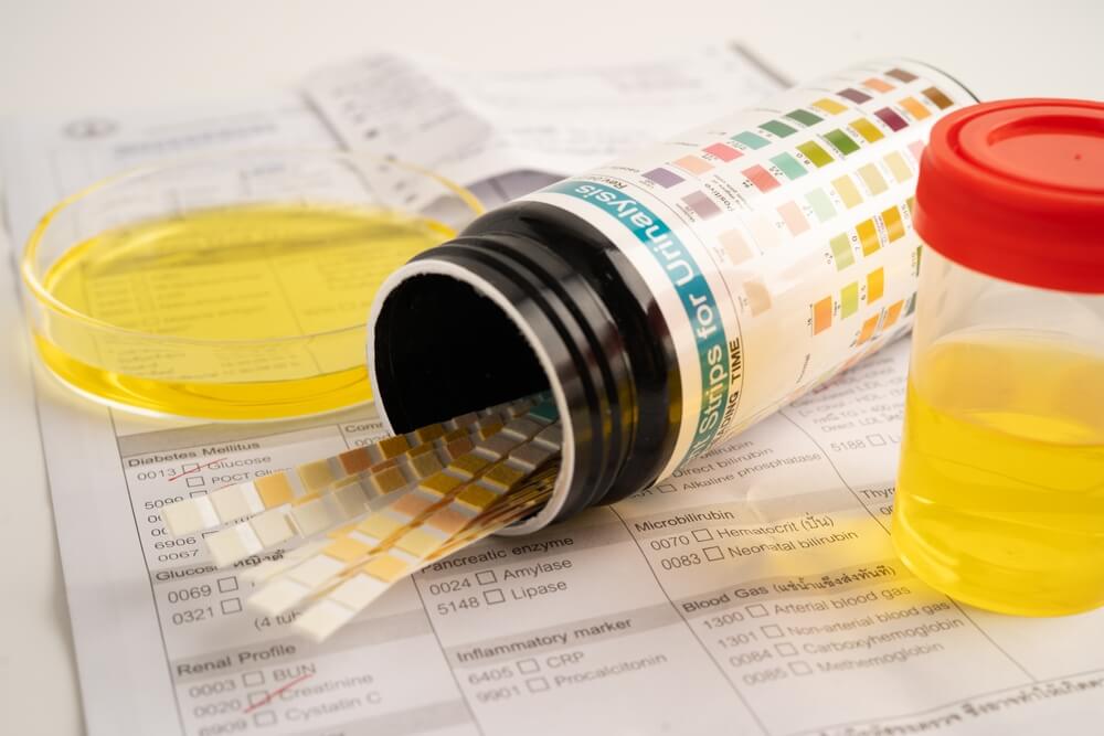 Trouble Urinating in Van Nuys CA