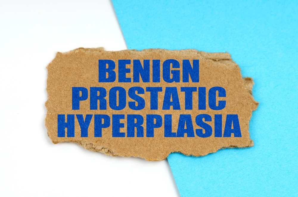 Non-Surgical BPH Treatment in Irvine CA
