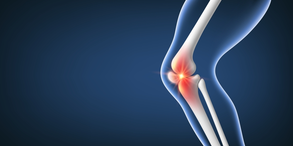 Interventional Radiology Knee Treatment Van Nuys CA