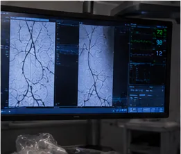 Angiography imaging displayed during an interventional procedure